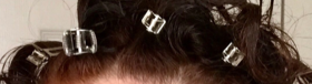 Root clips